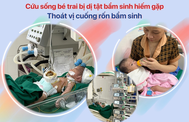 Sau gần 2 tháng điều trị, bé T.M.T. đã cai được máy thở, tập bú, tình trạng sức khỏe ổn định và đã được xuất viện.