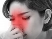 Clip Eva - Phòng và trị viêm mũi khi ngồi điều hòa bằng Đông y