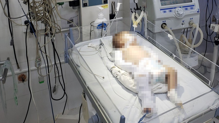 Cháu C. đang được điều trị tích cực tại bệnh viện. Ảnh: VTV