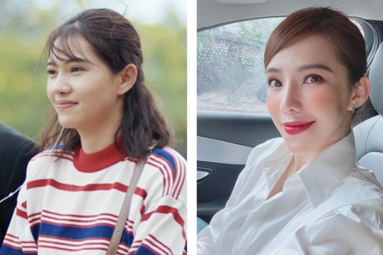 Gương mặt của cô có nhiều nét thay đổi so với trước. Chủ yếu là ở sống mũi, đôi mắt và phần xương hàm.