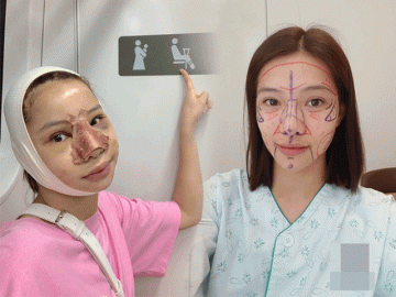 Đánh đổi vẻ đẹp tự nhiên thành nhân tạo, mỹ nhân VTV lên sóng ra sao mà tự nhận robot?