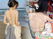 Làm đẹp - Mặc áo dây lộ tấm lưng chi chít mụn, là vì chị em chưa biết 10 cách trị mụn lưng giúp da trắng rẻ bèo này!