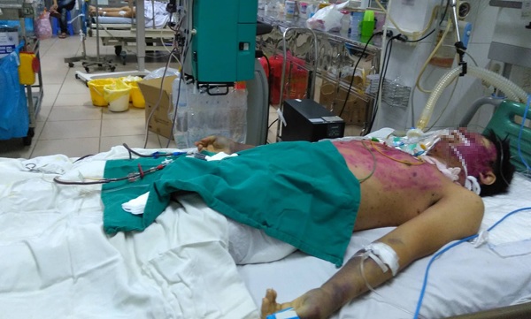 Thủy đậu nếu không được điều trị kịp thời dễ gây biến chứng nguy hiểm đến tính mạng. Ảnh minh họa. 