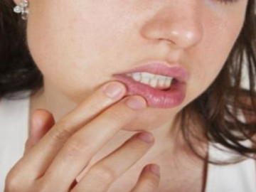 Chưa đầy 30 tuổi mà 2 tháng chỉ yêu một lần, vợ nghi chồng ngoài luồng khi trong miệng bỗng mọc...