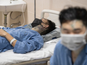 Ông bố trẻ ở Hải Dương tử vong vì mắc thủy đậu sau khi con trai vừa khỏi bệnh vài ngày