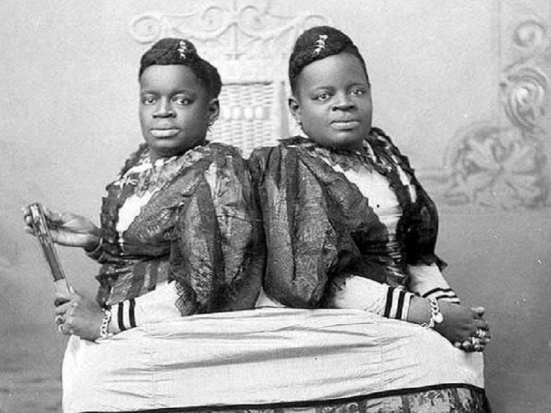 10. Millie và Christine McCoy cặp sinh đôi dính liền hông nhiều lần bị bán làm nô lệ. Chị em nhà McKoy đã có thể nói được 5 thứ tiếng, biết khiêu vũ, hát, chơi nhạc cụ, trở nên nổi tiếng và được mệnh danh là “Sơn ca 2 đầu”.  
