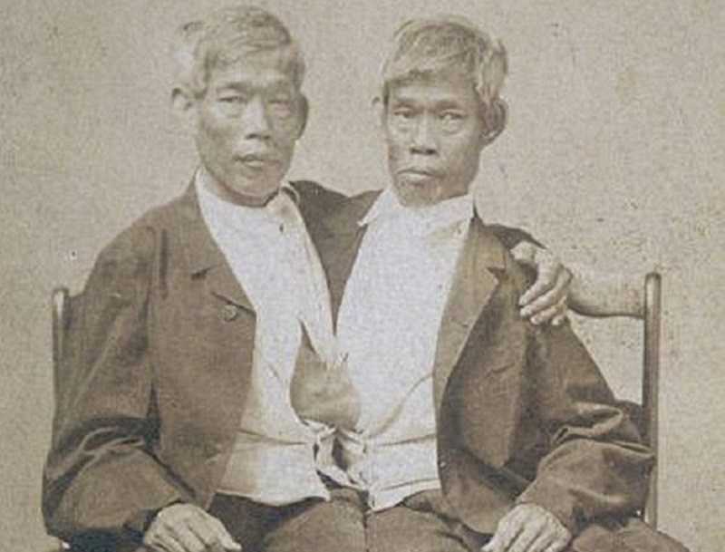 2. Chang và Eng Bunker là anh em dính liền thân được sinh ra ở Thái Lan. Họ cưới vợ và sinh 21 người con. Khi một người nếm thử vị chua thì người kia cũng cảm nhận được, và khi cù người này thì người kia cũng thấy buồn. 
