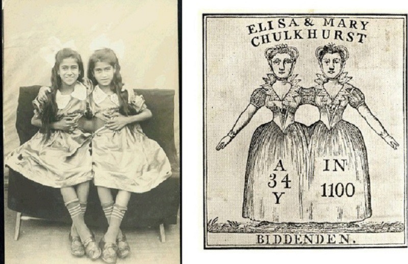 5. Eliza và Mary Chalkhurst được coi là một trong những trường hợp sinh đôi dính liền đầu tiên trên thế giới. Họ sinh ra trong 1 gia đình giàu có và khi chết đi đã để lại toàn bộ tài sản cho người dân nghèo trong làng.
