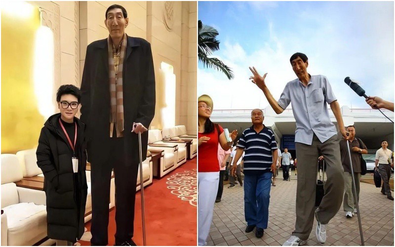 Ông Hỷ Thuận năm nay đã 72 tuổi, dù chiều cao vẫn giữ nguyên nhưng ông không còn là người cao nhất thế giới nữa.
