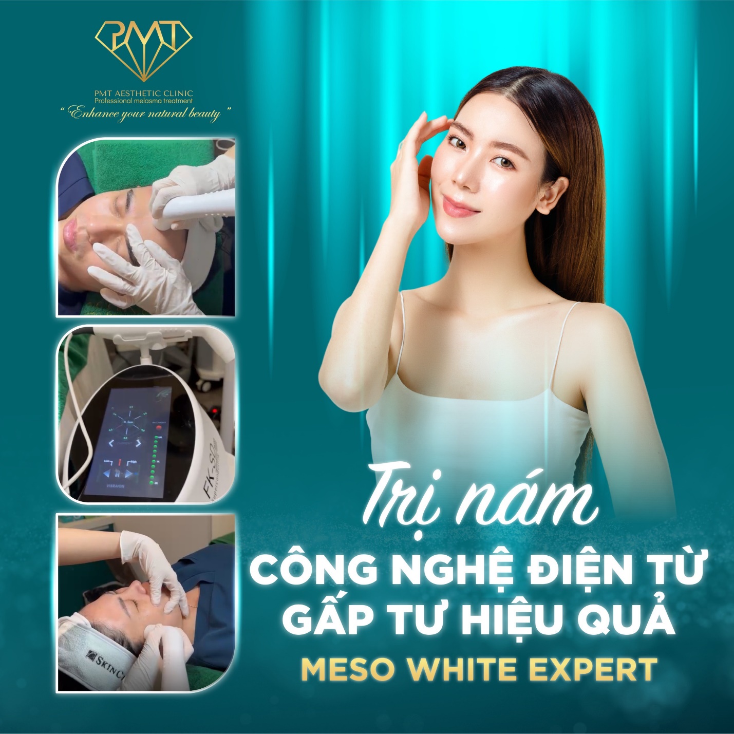 PMT Clinic tiên phong công nghệ trị nám bằng điện từ - 1