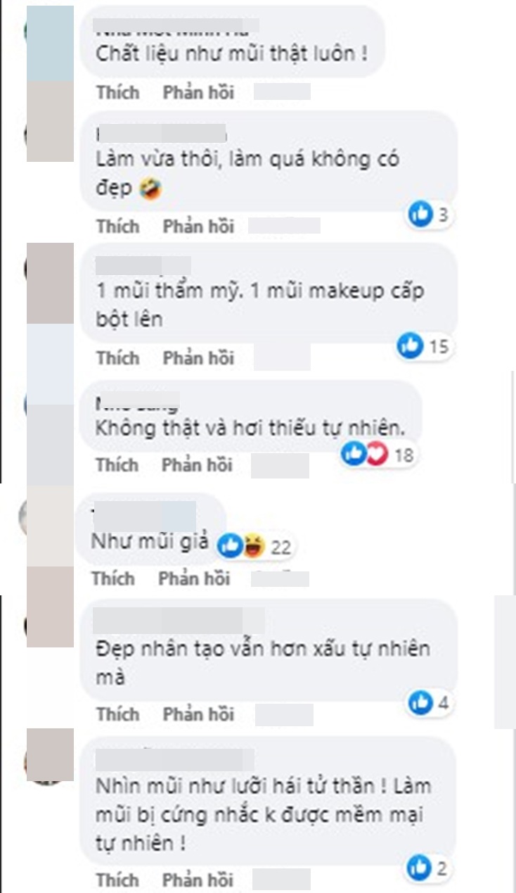 View - Có phải nâng mũi với chất liệu độn đắt tiền là bền, chuyên gia trong nghề tiết lộ sự thật ngã ngửa