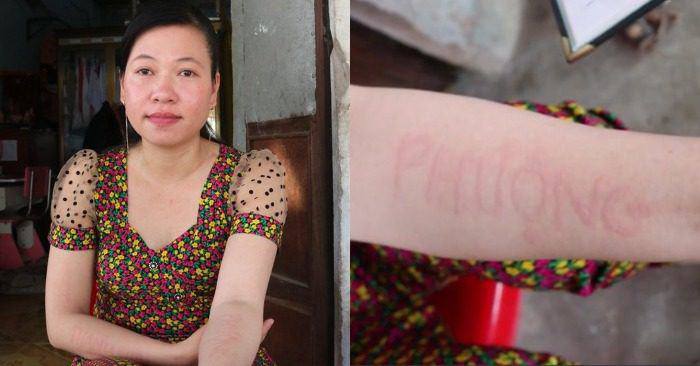 Chị Phượng viết tên của chính mình lên cánh tay.