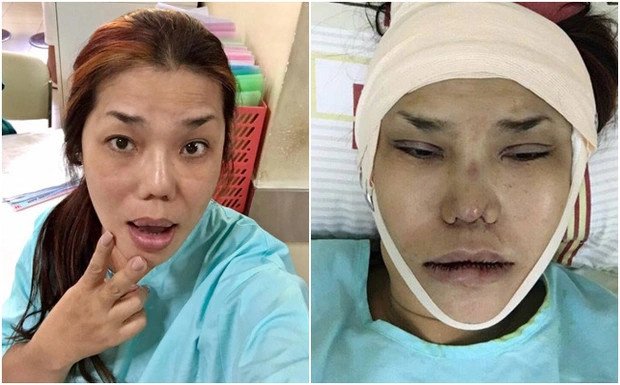 Đầu năm 2000. Cindy Thái Tài dành dụm gần 700 triệu đồng sang Thái Lan chuyển giới, quyết sống đúng với bản ngã của chính mình.