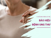 Sức khỏe - Nếu bị ung thư trên cơ thể sẽ có 3 chỗ đen, kiểm tra ngay trước khi quá muộn