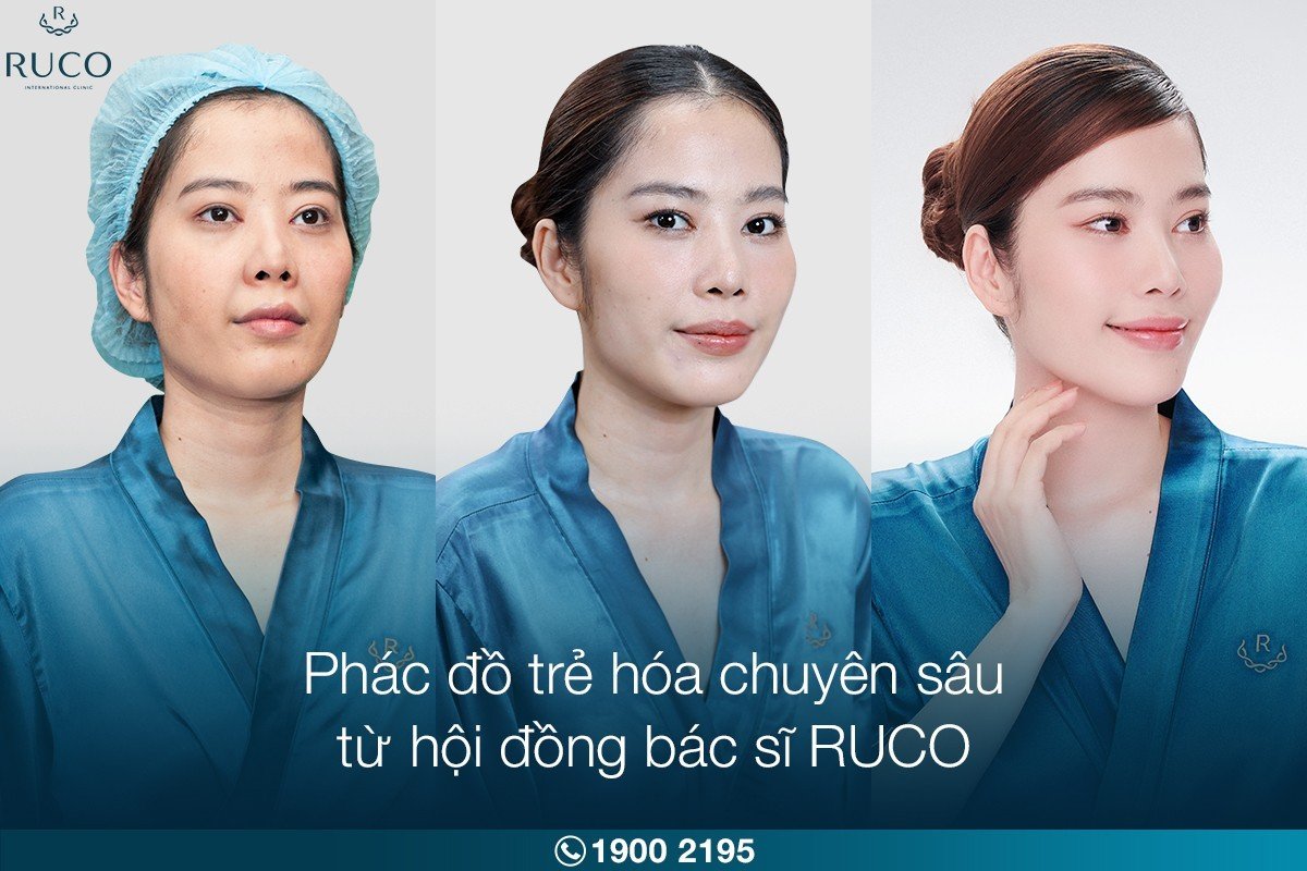 Nhan sắc ngày càng thăng hạng của Nam Em hậu “trùng tu” tại Ruco - 4