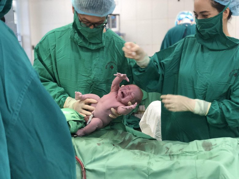 Bác sĩ Cường và ê kíp đang mổ bắt thai cho một sản phụ. (Ảnh: BSCC)