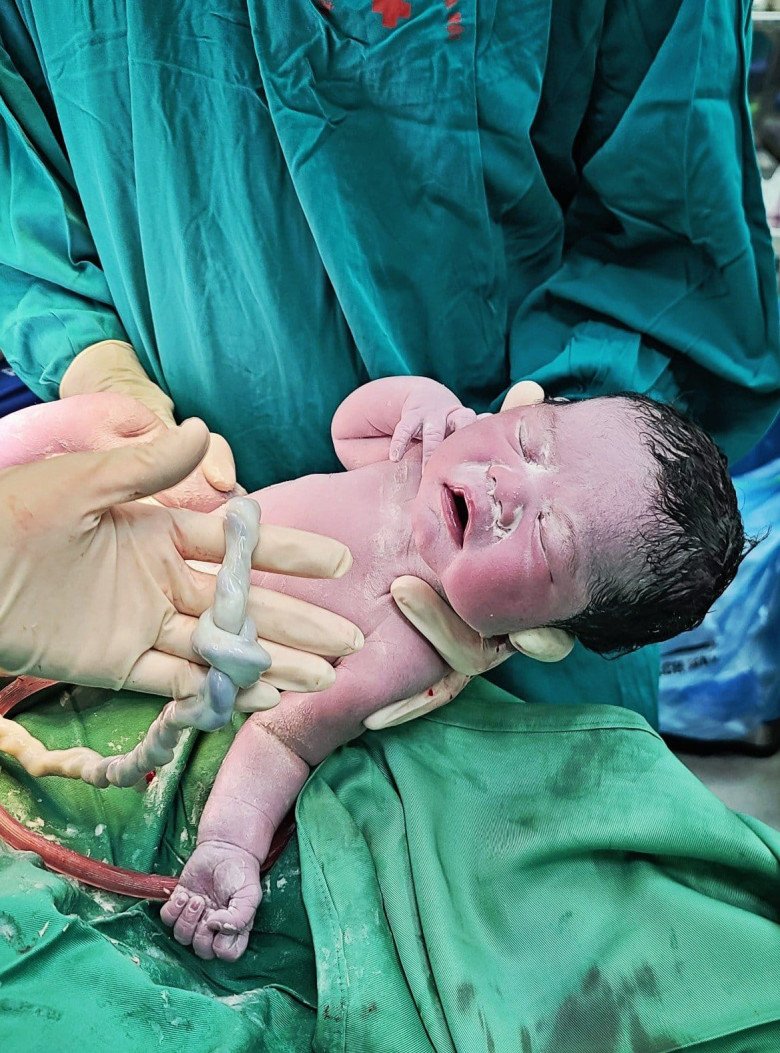 May mắn hai bé đều chào đời bình an và khỏe mạnh. (Ảnh: BSCC)