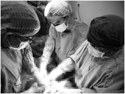 Bà bầu - Sản phụ 36 tuần nhập viện, huyết tương trắng đục như sữa đe dọa tính mạng