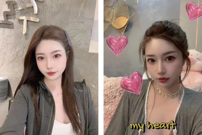 View - Muốn đẹp nhưng không đụng dao kéo, cô gái xỏ 16 sợi chỉ vào mũi và cái kết đau đớn