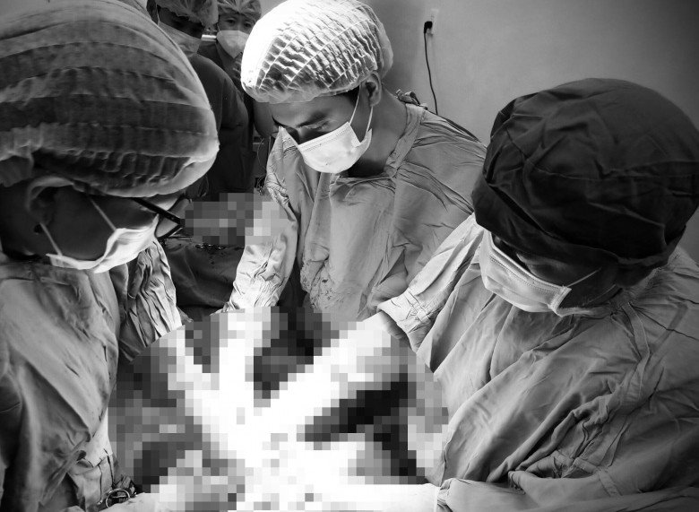 Các bác sĩ đang thực hiện phẫu thuật cho sản phụ U.