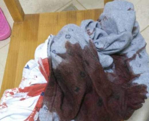 Bé trai 8 tuổi thức dậy trên vũng máu, BS nói nguyên nhân từ thực phẩm mà 100% trẻ nào cũng ăn - 2