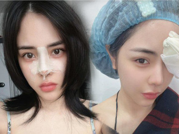 Bị nói sửa hết mặt vẫn không đẹp, bạn gái Huỳnh Anh nức nở, cầu xin CĐM đừng gây tổn thương mình