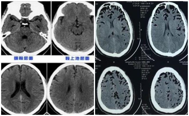 Não lỗ chỗ như tổ ong sau quan hệ tình dục, bác sĩ cảnh báo kiểu người này phải kiêng quan hệ - 1