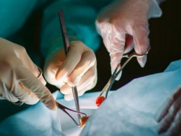 Chuyên gia nam học giải đáp 4 lầm tưởng về thắt ống dẫn tinh