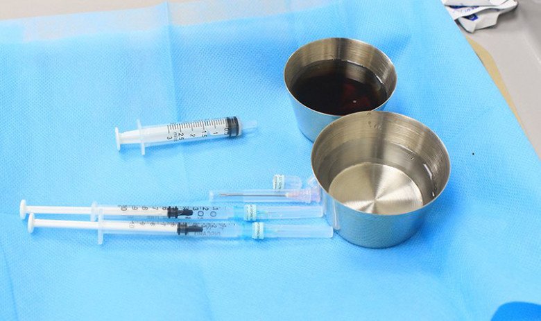 Botox được nhiều người ưa chuộng vì có hiệu quả nhanh lại không cần phải đụng chạm dao kéo.