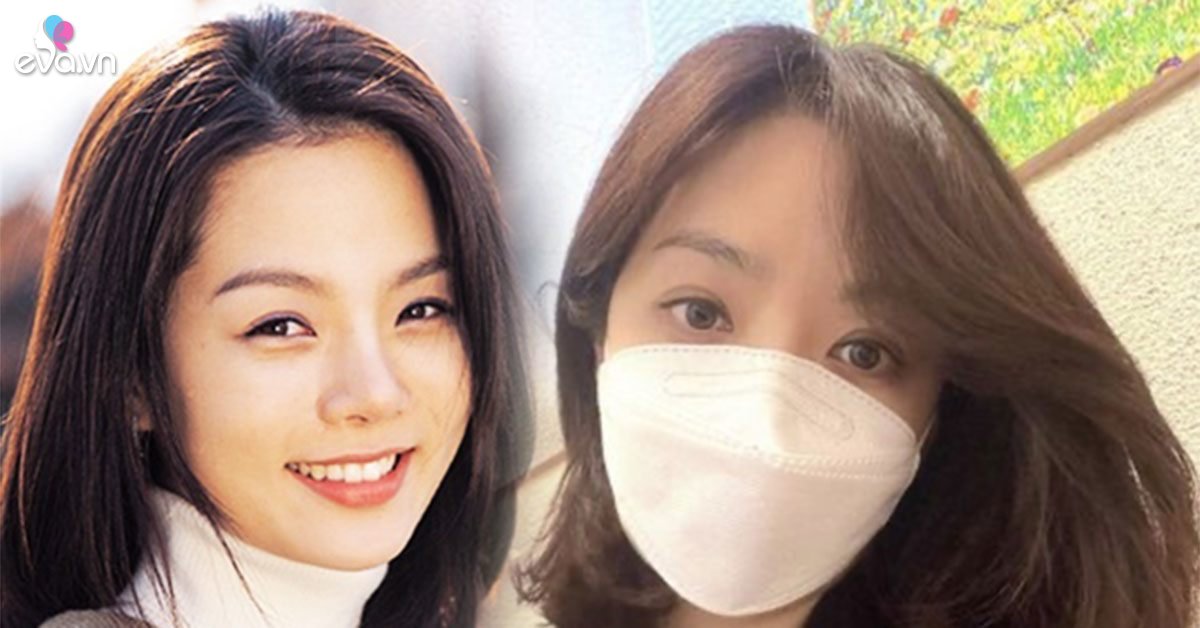 View - Nữ thần thanh xuân Chae Rim và hành trình lấy lại nhan sắc sau di chứng phẫu thuật thẩm mỹ