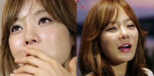 Những khoảnh khắc trước đây làm công chúng thậm chí không nhận ra đây là Chae Rim. 