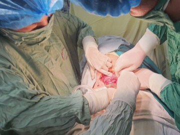 Cứu sống thai nhi gặp biến chứng nguy hiểm trong bụng mẹ