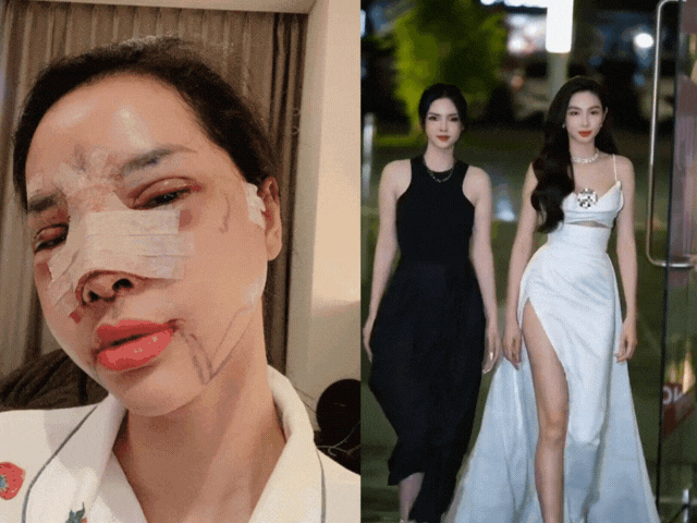 Mẹ bỉm 2 con thẩm mỹ đổi đời, đứng cạnh Hoa hậu Thùy Tiên vẫn đẹp rạng ngời, khó bị lấn át