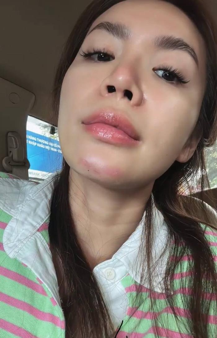 img srchttps://cdn.eva.vn/upload/2-2023/images/2023-06-20/sao-viet-tai-nan-khi-quay-gameshow-hoa-hau-hoang-loan-bi-flycam-dap-vao-mat-vu-ha-rach-da-dau-chay-m-yu-1687240936-272-width780height585.jpeg width660 /