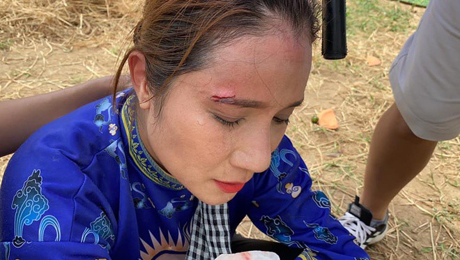 Vết thương rất sâu cạnh chân mày khiến nữ MC chảy nhiều máu.