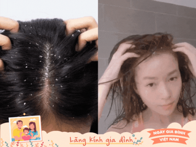 Làm đẹp - Phụ nữ xưa không dùng dầu gội, trị cả vảy gàu với nguyên liệu từ nhà bếp, giá chỉ vài nghìn 