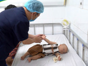 Sức khỏe - Nhiều trẻ mắc tay chân miệng bị biến chứng viêm não, BS cảnh báo dấu hiệu cha mẹ cần đưa con đi viện ngay