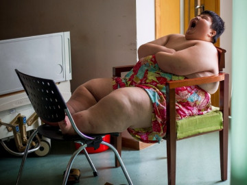 Sợ chết, cậu bé 14 tuổi nặng 180kg khóc xin bác sĩ giúp giảm cân, kết cục năm 21 tuổi khiến mọi người thở dài