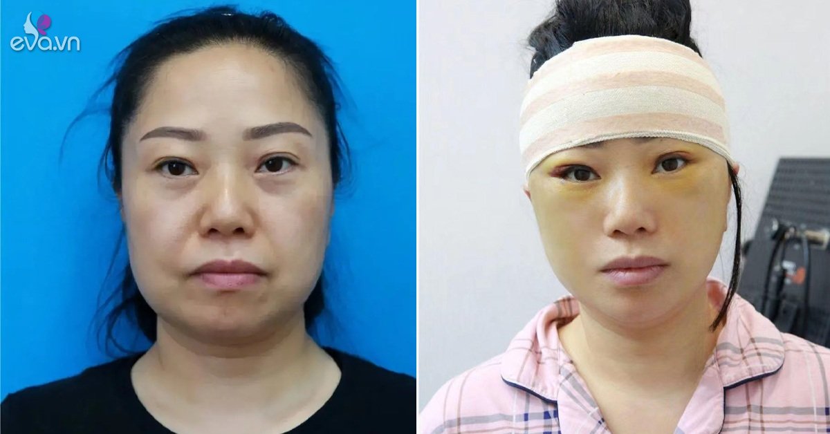 Gallery - Người phụ nữ 47 tuổi bỏ nhà đi cắt da, 7 ngày sau trở về gia đình nhận không ra