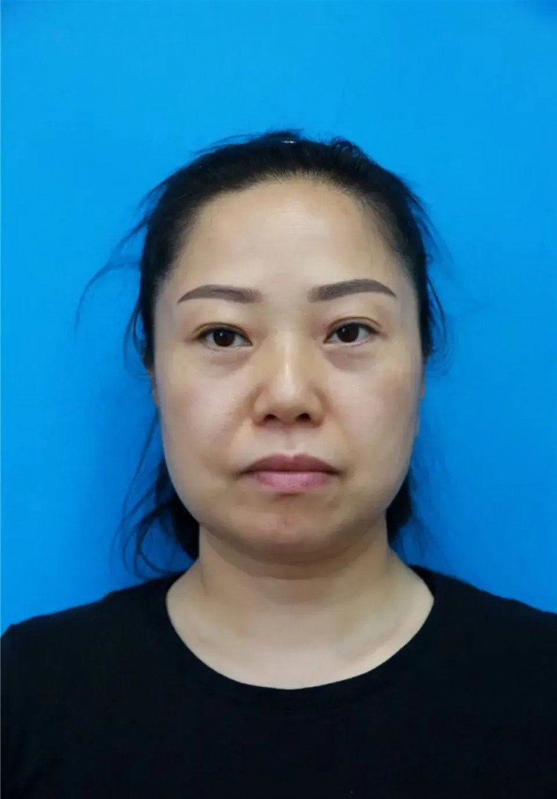 Người phụ nữ 47 tuổi bỏ nhà đi amp;#34;cắt daamp;#34;, 7 ngày sau trở về gia đình nhận không ra - 1