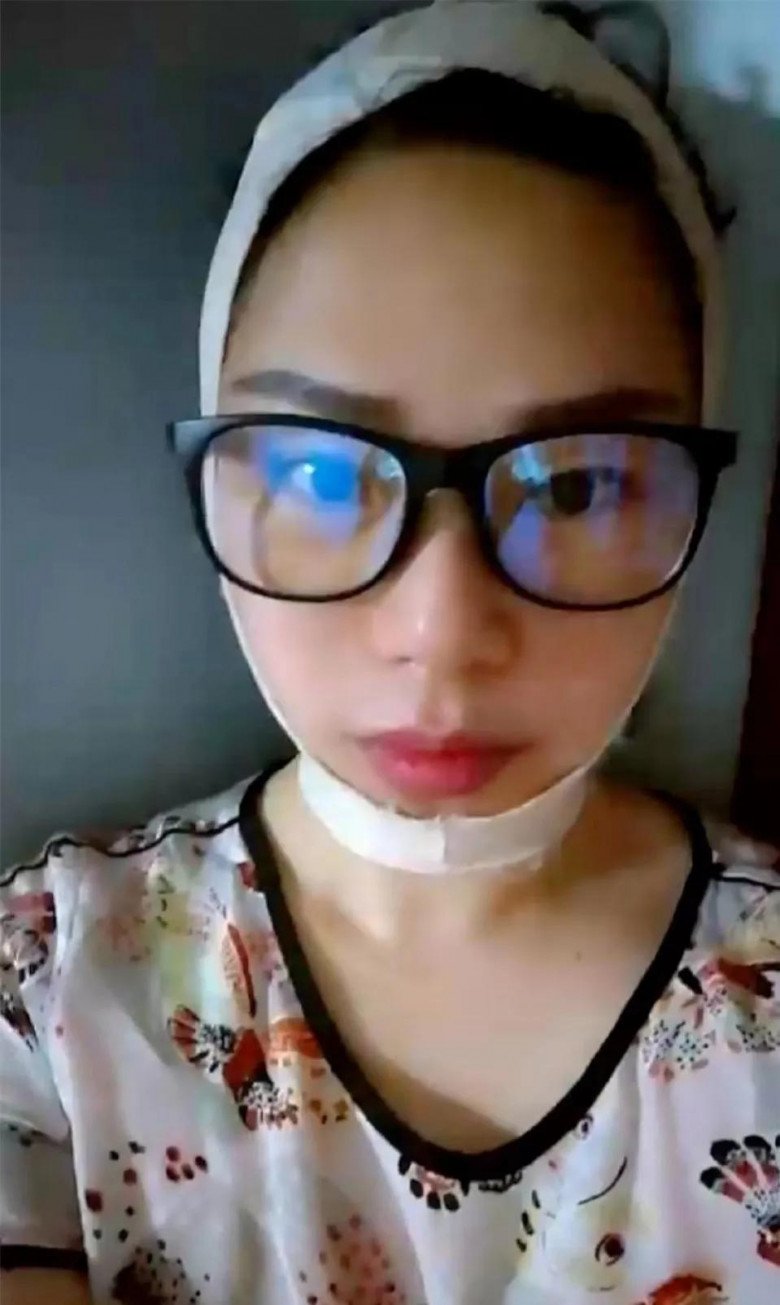 Người phụ nữ 47 tuổi cũng cho biết việc đeo đai nâng cơ xuyên suốt những ngày đầu dù khá khó chịu nhưng cô luôn cố gắng để có thể có được hiệu quả tốt nhất.