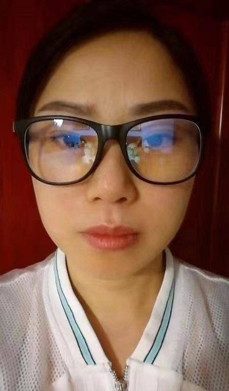 Và đây là hình ảnh sau 6 tháng căng da mặt của cô. Nhìn vào làn da căng mịn này, khó ai nghĩ rằng đây là một phụ nữ U50.