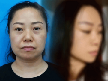 Người phụ nữ 47 tuổi bỏ nhà đi "cắt da", 7 ngày sau trở về gia đình nhận không ra