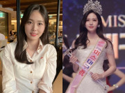 Giải trí - Nàng hậu tử vong ở tuổi 26 sau ca phẫu thuật: Những hình ảnh cuối đời được tiết lộ