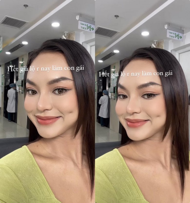 View - Không cao bằng Mai Phương Thúy nhưng vòng 3 ngang hàng, người đẹp lận đận cặp chân mày ẩn ý chuyện thẩm mỹ