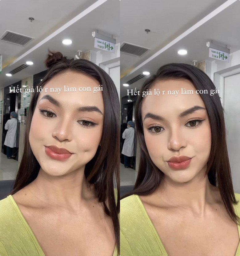 View - Không cao bằng Mai Phương Thúy nhưng vòng 3 ngang hàng, người đẹp lận đận cặp chân mày ẩn ý chuyện thẩm mỹ