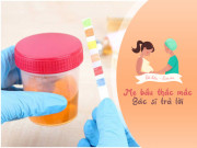 Bà bầu - Tại sao bác sĩ sản khoa cho mẹ bầu làm xét nghiệm nước tiểu mỗi lần thăm khám thai?