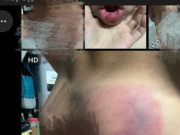 Tin tức - Cô giáo dạy thêm bị tố đánh học sinh chảy máu miệng, sưng đầu