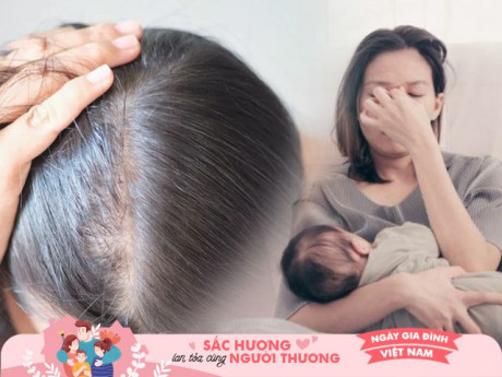 Mặc cảm sau sinh vì tóc rụng triền miên, đầu hói cả mảng, nhớ lời mẹ dặn tôi mới thấm thía
