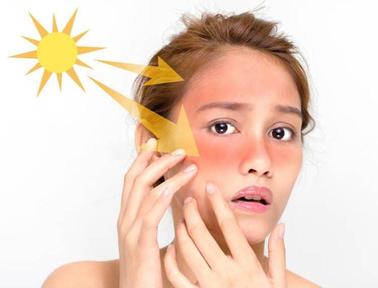 Kem chống nắng giúp làn da chị em tươi trẻ khỏe mạnh hơn mỗi ngày 